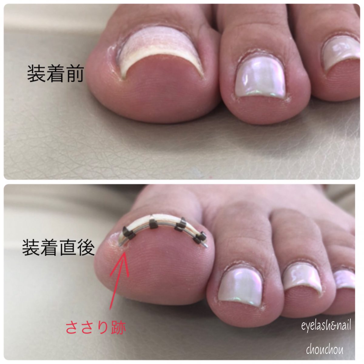 まきづめリフト💅