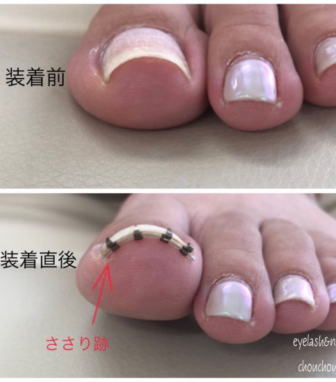 まきづめリフト💅